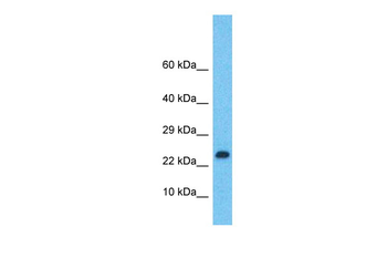LMO2 Rabbit Polyclonal Antibody