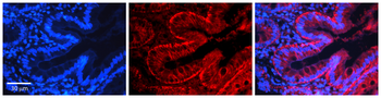 NFKB2 Rabbit Polyclonal Antibody