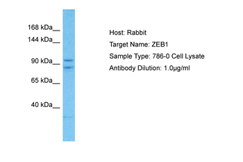 ZEB1 Rabbit Polyclonal Antibody