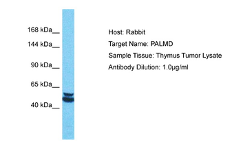 PALMD Rabbit Polyclonal Antibody