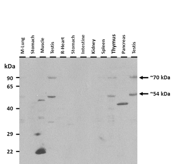 Runx2 Rabbit Polyclonal Antibody