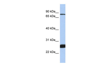 NFE2L1 Rabbit Polyclonal Antibody