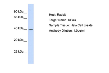 RFX3 Rabbit Polyclonal Antibody