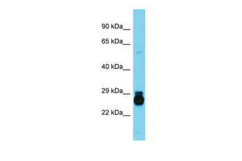 Hoxc6 Rabbit Polyclonal Antibody