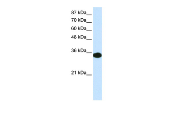 HOXD4 Rabbit Polyclonal Antibody