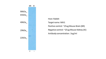 MXI1 Rabbit Polyclonal Antibody