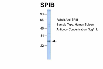 SPIB Rabbit Polyclonal Antibody