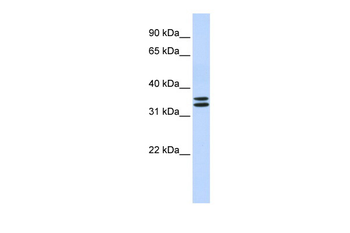TAL1 Rabbit Polyclonal Antibody