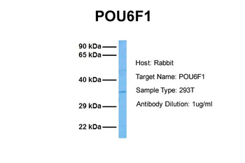 POU6F1 Rabbit Polyclonal Antibody