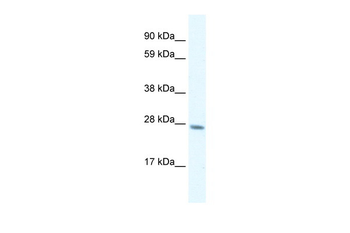 GTF2F2 Rabbit Polyclonal Antibody