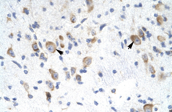 GTF2F2 Rabbit Polyclonal Antibody