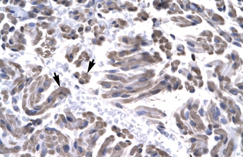 GTF2H3 Rabbit Polyclonal Antibody