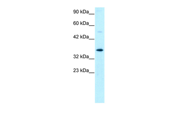 GTF2H3 Rabbit Polyclonal Antibody