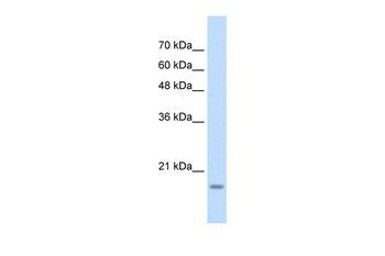 YAF2 Rabbit Polyclonal Antibody