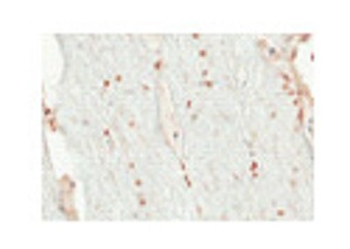OLIG2 Rabbit Polyclonal Antibody