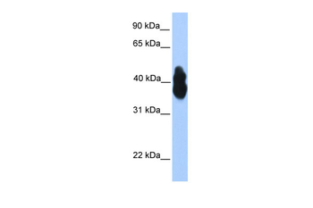 OLIG2 Rabbit Polyclonal Antibody