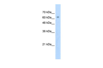 ZNF274 Rabbit Polyclonal Antibody