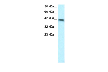 ERCC8 Rabbit Polyclonal Antibody