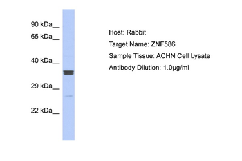 ZNF586 Rabbit Polyclonal Antibody