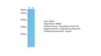 NR0B1 Rabbit Polyclonal Antibody