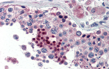 NR0B1 Rabbit Polyclonal Antibody
