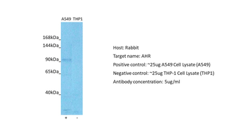 AHR Rabbit Polyclonal Antibody