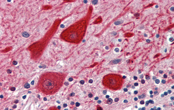 EMX2 Rabbit Polyclonal Antibody