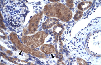 ZNFN1A2 Rabbit Polyclonal Antibody