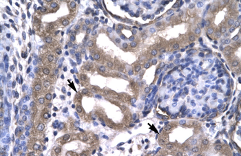 KIN Rabbit Polyclonal Antibody