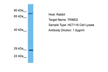 TRIM32 Rabbit Polyclonal Antibody