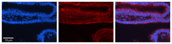 TRIM32 Rabbit Polyclonal Antibody