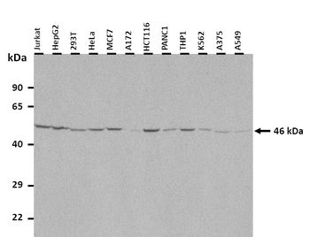 FOXF2 Rabbit Polyclonal Antibody