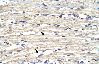 FBXL11 Rabbit Polyclonal Antibody