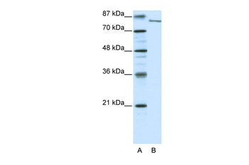 FBXL11 Rabbit Polyclonal Antibody