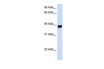 FOXE1 Rabbit Polyclonal Antibody