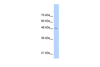 TLR6 Rabbit Polyclonal Antibody
