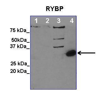 RYBP Rabbit Polyclonal Antibody