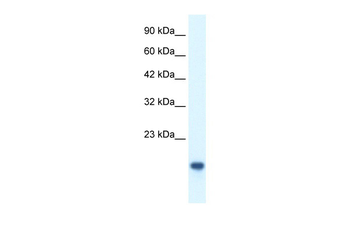 MYCBP Rabbit Polyclonal Antibody