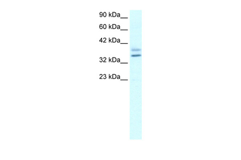EHF Rabbit Polyclonal Antibody