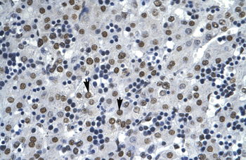 AATF Rabbit Polyclonal Antibody