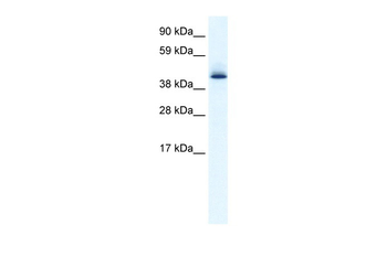 AATF Rabbit Polyclonal Antibody