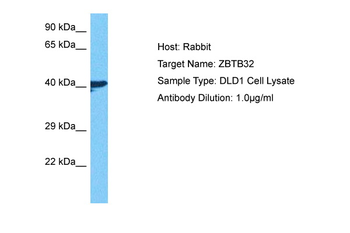 ZBTB32 Rabbit Polyclonal Antibody