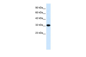 ZBTB32 Rabbit Polyclonal Antibody
