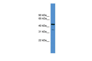 TAF5L Rabbit Polyclonal Antibody