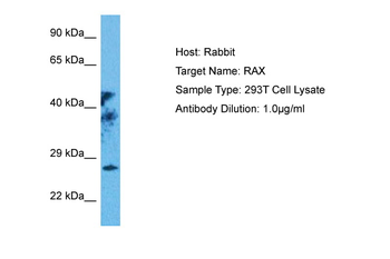 RAX Rabbit Polyclonal Antibody