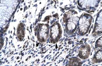 HCLS1 Rabbit Polyclonal Antibody