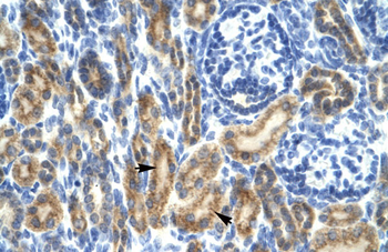 HCLS1 Rabbit Polyclonal Antibody