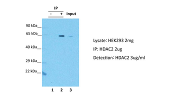 HDAC2 Rabbit Polyclonal Antibody
