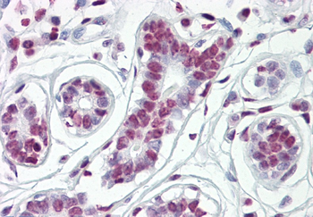 HDAC2 Rabbit Polyclonal Antibody