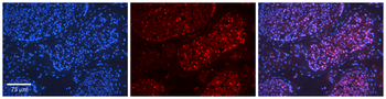HDAC2 Rabbit Polyclonal Antibody